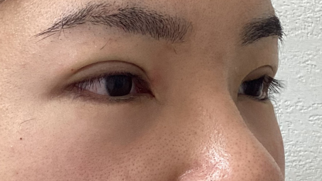 Postoperative Condition Part 1