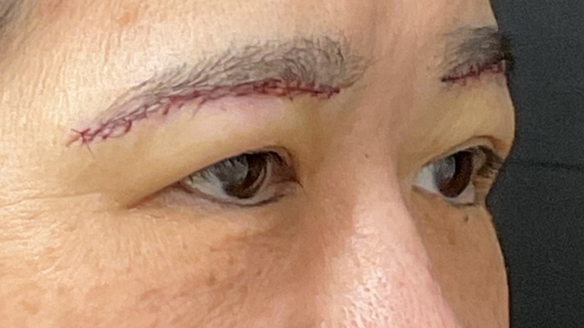 Postoperative Condition Part 1