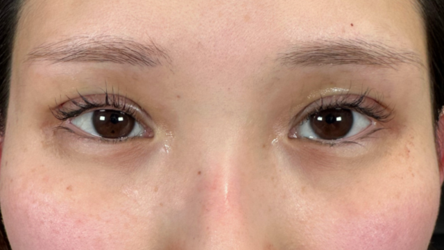 手术前的状态 其一