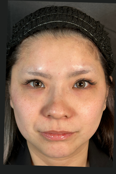 手術前の状態 その1