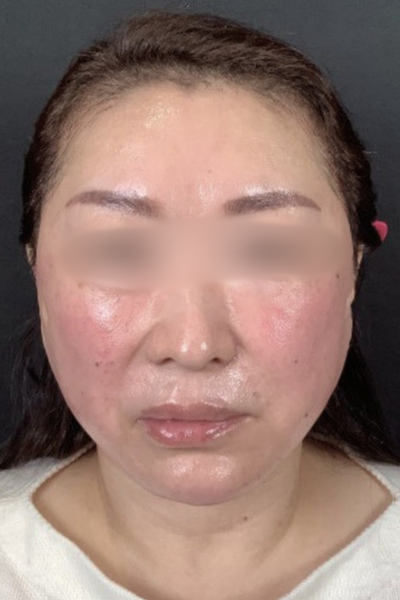 手術前の状態 その1