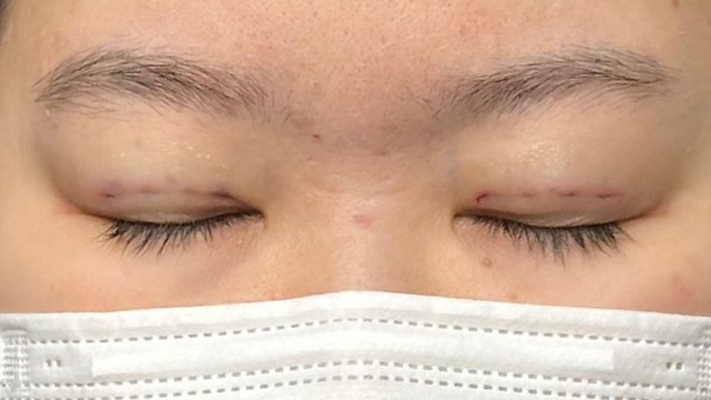 Postoperative Condition Part 1