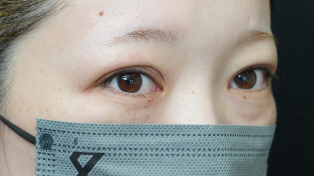 Postoperative Condition Part 1