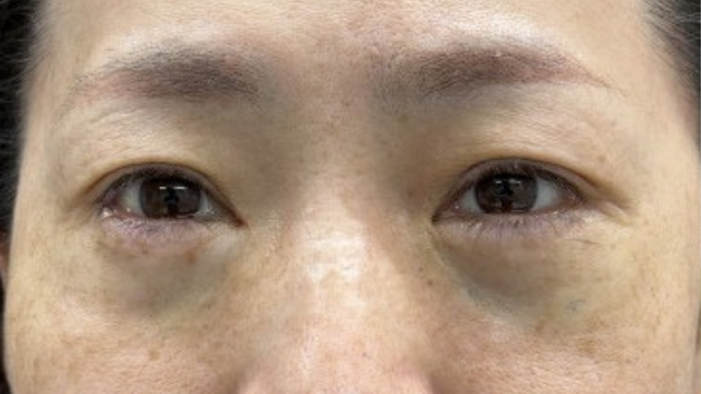 Postoperative Condition Part 1