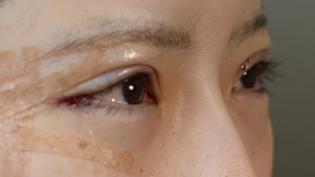 Postoperative Condition Part 1