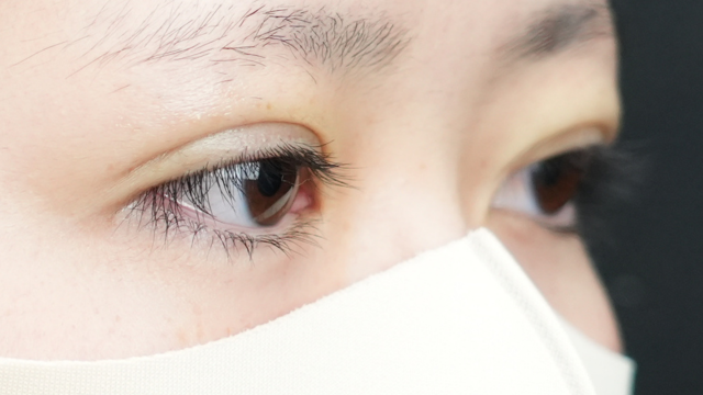 Postoperative Condition Part 1