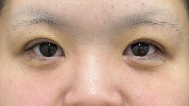 Postoperative Condition Part 1