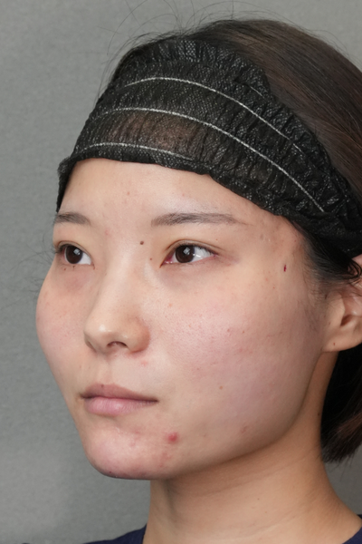 Postoperative Condition Part 1