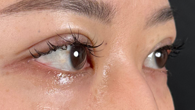 Postoperative Condition Part 1