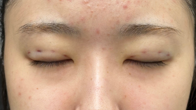 Postoperative Condition Part 1