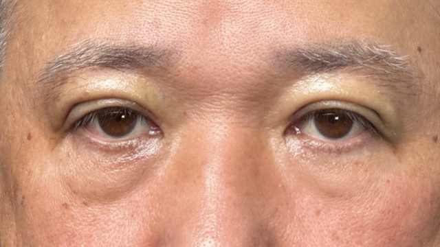 Postoperative Condition Part 1