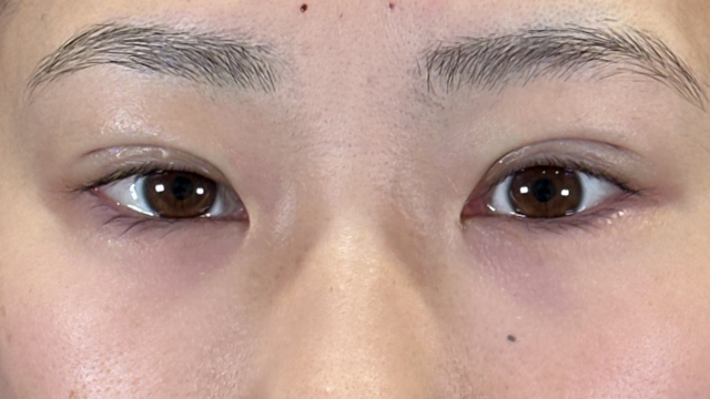 Postoperative Condition Part 1