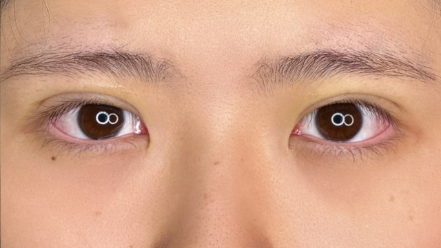 Postoperative Condition Part 1