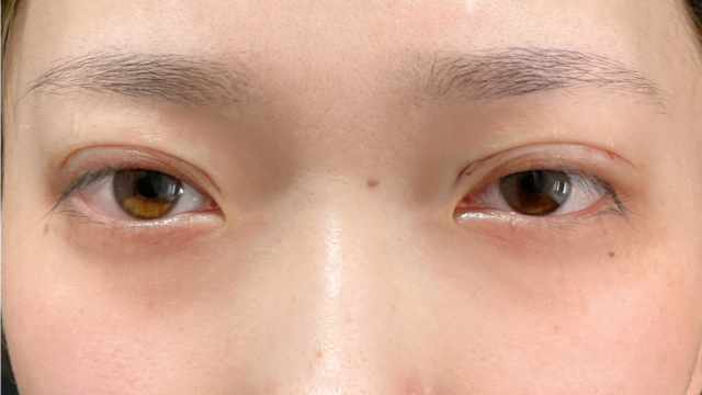 Postoperative Condition Part 1