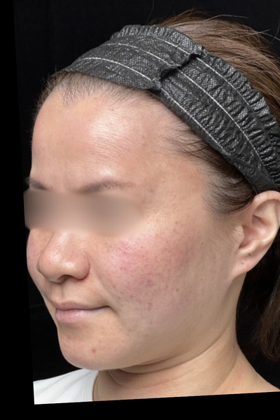 手術前の状態 その1