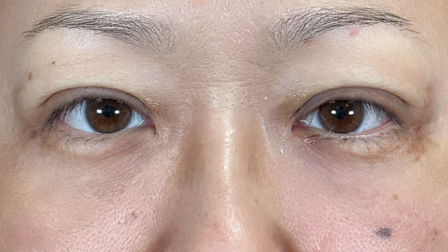 Postoperative Condition Part 1