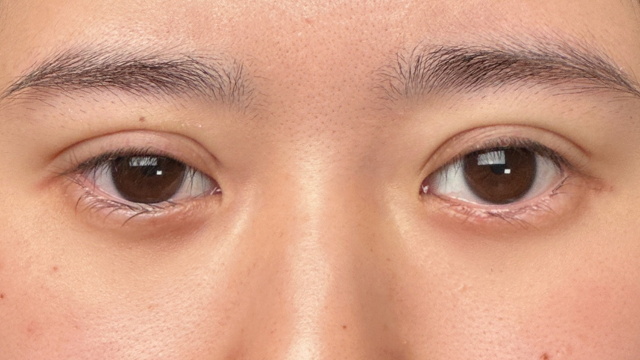 Postoperative Condition Part 1