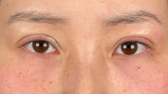 Postoperative Condition Part 1