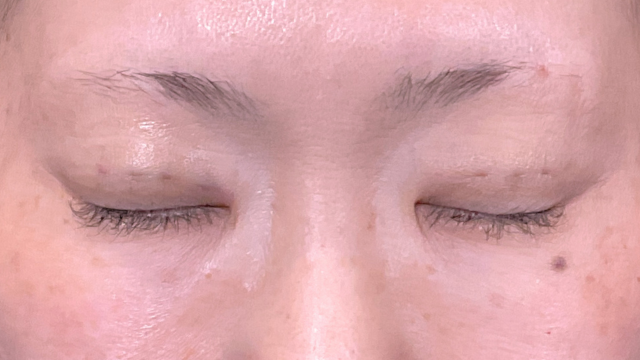 Postoperative Condition Part 1