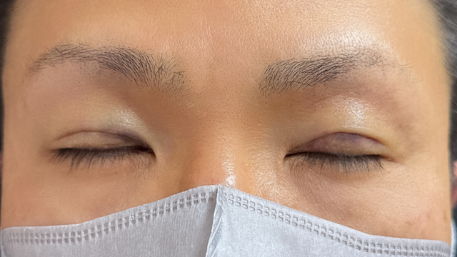 Postoperative Condition Part 1