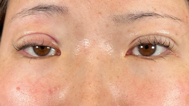 Postoperative Condition Part 1