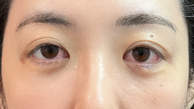 Postoperative Condition Part 1