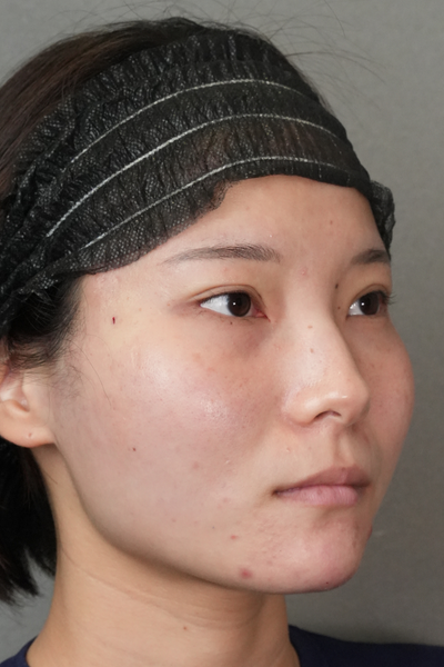 Postoperative Condition Part 1