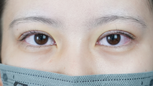 Postoperative Condition Part 1