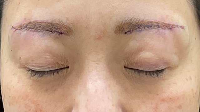 Postoperative Condition Part 1