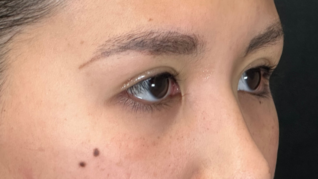 Postoperative Condition Part 1