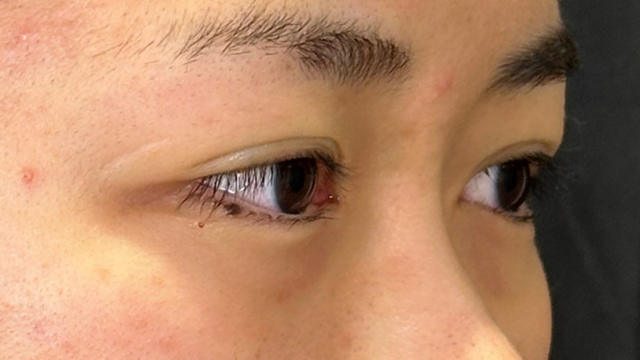 Postoperative Condition Part 1