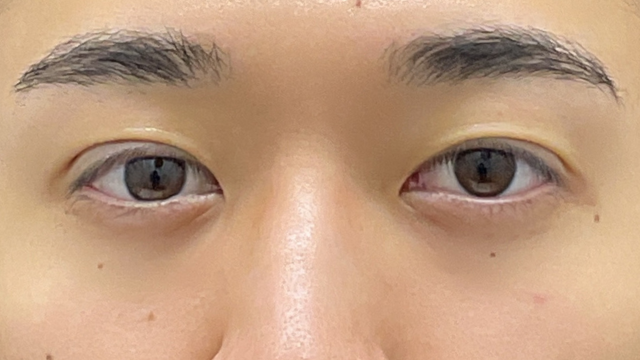 Postoperative Condition Part 1