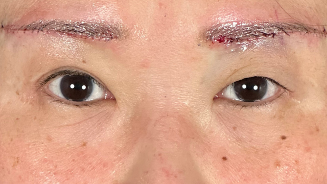 Postoperative Condition Part 1