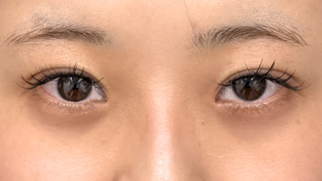 Postoperative Condition Part 1