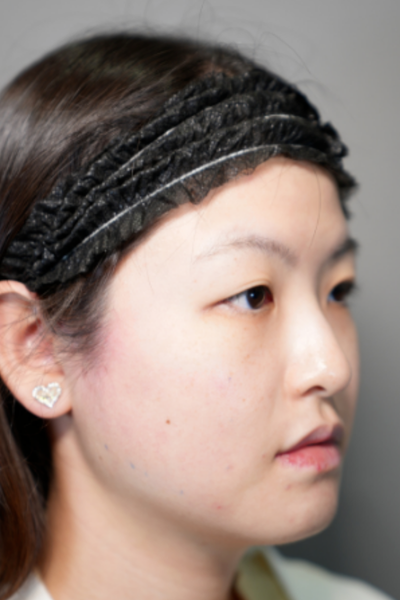 Postoperative Condition Part 1