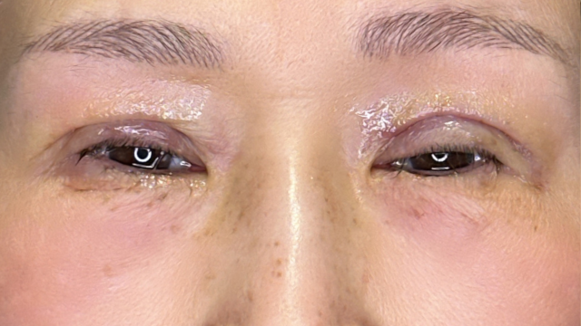 Postoperative Condition Part 1