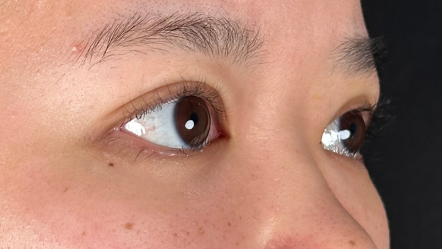 Postoperative Condition Part 1