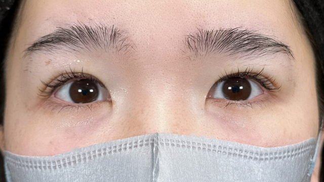 Postoperative Condition Part 1