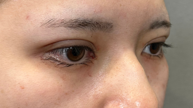 Postoperative Condition Part 1