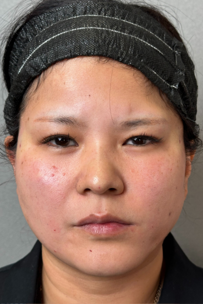 手術前の状態 その1