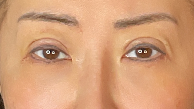 Postoperative Condition Part 1