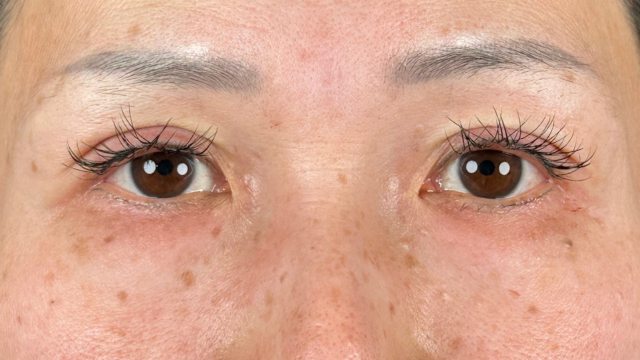 Postoperative Condition Part 1