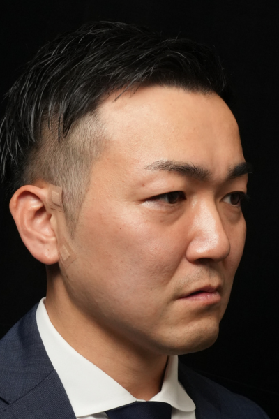 Postoperative Condition Part 1