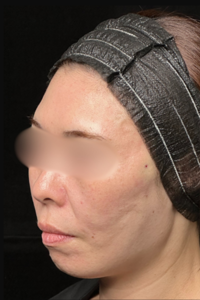 Postoperative Condition Part 1