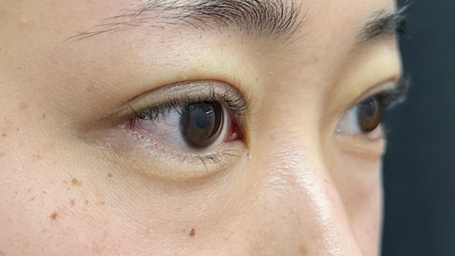 Postoperative Condition Part 1