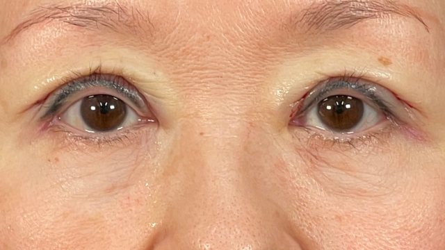 Postoperative Condition Part 1