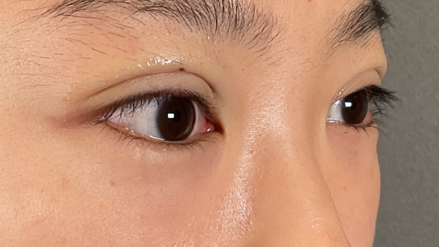 Postoperative Condition Part 1