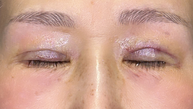 Postoperative Condition Part 1