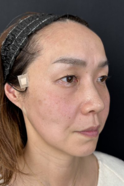 手術前の状態 その1