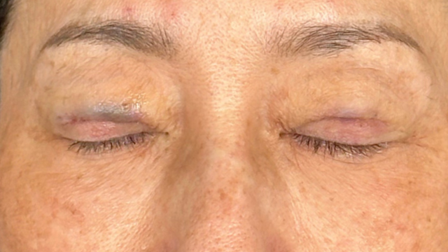 Postoperative Condition Part 1